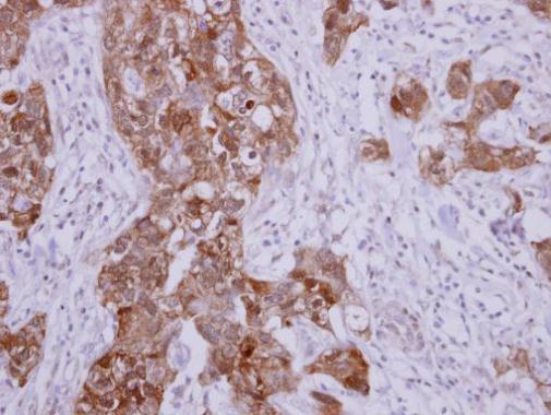 Anti-HSP70 1B antibody used in IHC (Formalin-fixed paraffin-embedded sections). GTX112963
