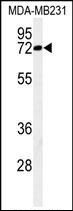 Anti-MCMBP antibody used in Western blot. GTX53670