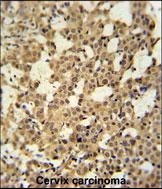 Anti-MCMBP antibody used in IHC (Formalin-fixed paraffin-embedded sections). GTX53670