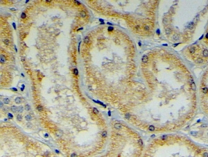 Anti-MDG1 / DNAJB9 antibody, C-term used in IHC (Formalin-fixed paraffin-embedded sections). GTX26053