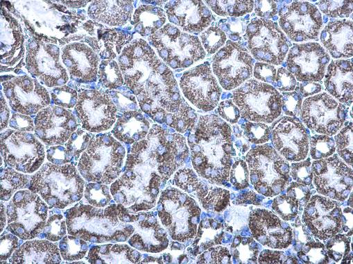 Anti-MDH2 antibody used in IHC (Formalin-fixed paraffin-embedded sections). GTX105870
