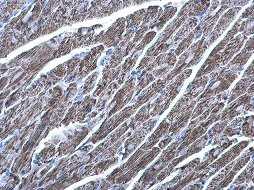 Anti-MDH2 antibody used in IHC (Formalin-fixed paraffin-embedded sections). GTX105870