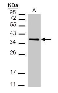 Anti-MDH2 antibody used in Western blot. GTX105870