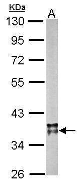 Anti-MDH2 antibody used in Western blot. GTX105870