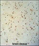 Anti-MED25 antibody used in IHC (Formalin-fixed paraffin-embedded sections). GTX53612