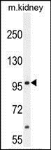 Anti-MED25 antibody used in Western blot. GTX53612