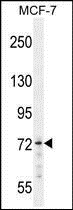 Anti-MED25 antibody used in Western blot. GTX53612