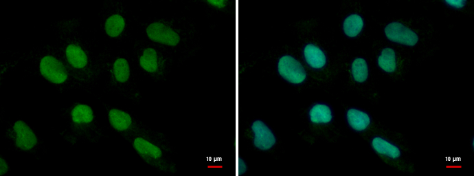 Anti-MEF2B antibody used in ICC/IF. GTX119810