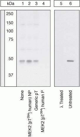 Anti-MEK2 (phospho Thr394) antibody used in Western blot. GTX24757