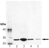 Anti-Membrin antibody [4HAD6] used in Western blot. GTX13511