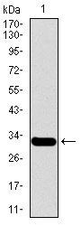 Anti-MESP2 antibody [1B3F9] used in Western blot. GTX60671