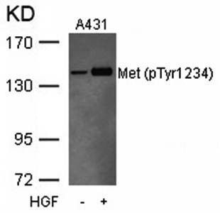 Anti-Met (phospho Tyr1234) antibody used in Western blot. GTX38574