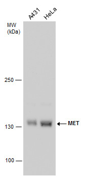 Anti-MET antibody [GT1586] used in Western blot. GTX631993