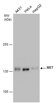 Anti-MET antibody [GT556] used in Western blot. GTX631992