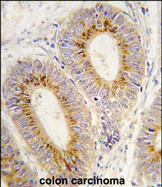 Anti-Methionyl tRNA synthetase antibody, C-term used in IHC (Formalin-fixed paraffin-embedded sections). GTX81276