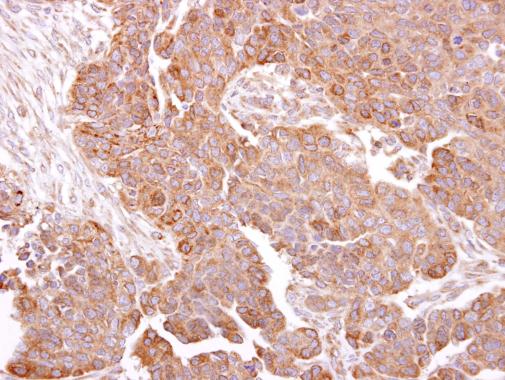 Anti-METTL13 antibody used in IHC (Formalin-fixed paraffin-embedded sections). GTX120626
