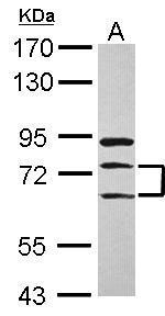 Anti-METTL13 antibody used in Western blot. GTX120626