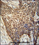 Anti-METTL4 antibody used in IHC (Formalin-fixed paraffin-embedded sections). GTX53629