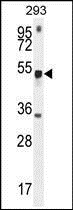 Anti-METTL4 antibody used in Western blot. GTX53629