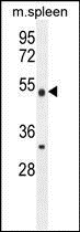 Anti-METTL4 antibody used in Western blot. GTX53629