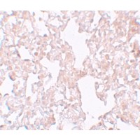Anti-MFSD1 antibody used in Immunohistochemistry. GTX85148