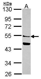 Anti-MGAT2 antibody [N1C1] used in Western blot. GTX114926