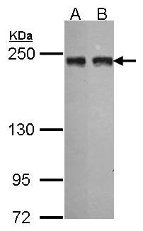 Anti-MIA3 antibody [N1], N-term used in Western blot. GTX101827