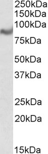 Anti-MIC1 / C18orf8 antibody, Internal used in Western blot. GTX88992