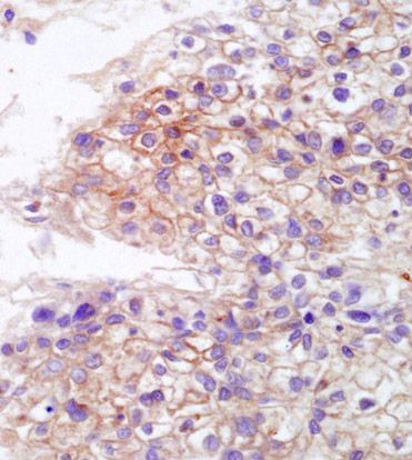 Anti-MICB antibody used in IHC (Formalin-fixed paraffin-embedded sections). GTX60191