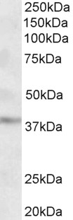 Anti-MICS1 / GHITM (aa117-127) antibody, Internal used in Western blot. GTX88163