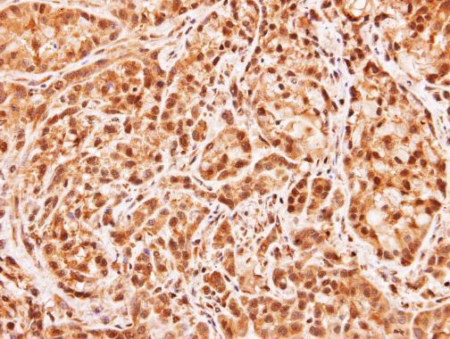 Anti-MID1IP1 antibody used in IHC (Formalin-fixed paraffin-embedded sections). GTX106864
