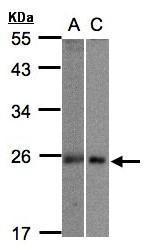 Anti-MID1IP1 antibody used in Western blot. GTX106864