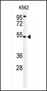 Anti-Mitochondrial calcium uptake 1 antibody used in Western blot. GTX53535