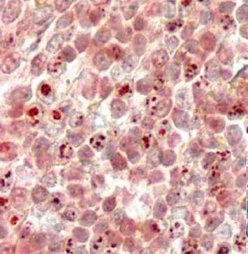 Anti-MLL2 antibody, N-term used in IHC (Formalin-fixed paraffin-embedded sections). GTX15962