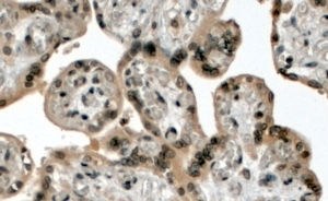 Anti-MLL2 antibody, N-term used in IHC (Formalin-fixed paraffin-embedded sections). GTX15962