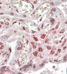 Anti-MLX antibody, Internal used in IHC (Formalin-fixed paraffin-embedded sections). GTX88235