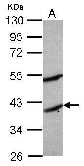 Anti-MOGAT2 antibody used in Western blot. GTX117145