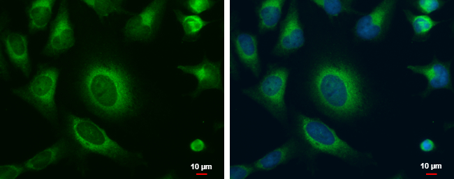 Anti-MOSC1 antibody used in ICC/IF. GTX120917