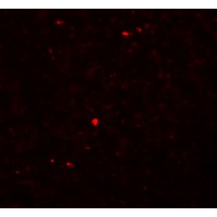 Anti-MOX1 antibody used in ICC/IF. GTX84998