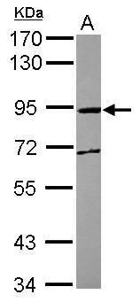 Anti-MPEG1 antibody [N1N3] used in Western blot. GTX122198