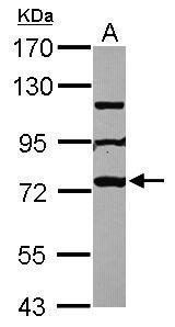 Anti-MPHOSPH10 antibody used in Western blot. GTX112221