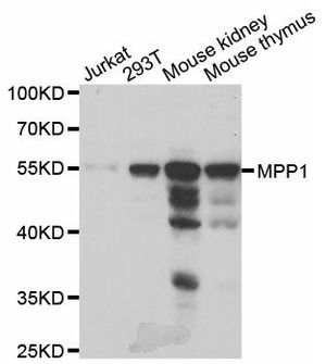 Anti-MPP1 antibody used in Western blot. GTX54346