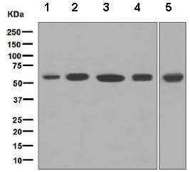 Anti-MPP1 antibody [EPR5864] used in Western blot. GTX63196