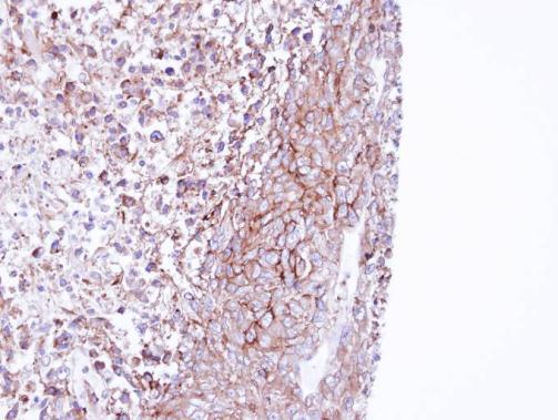 Anti-MPP1 antibody [N1C1] used in IHC (Formalin-fixed paraffin-embedded sections). GTX111779