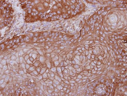 Anti-MPP1 antibody [N3C3] used in IHC (Formalin-fixed paraffin-embedded sections). GTX111341