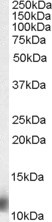 Anti-MPS1 / RPS27 antibody, N-term used in Western blot. GTX89805