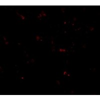 Anti-MPYS antibody used in ICC/IF. GTX85266