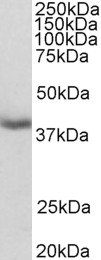 Anti-MRG15 / MORF4L1 antibody, N-term used in Western blot. GTX89736