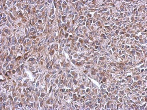 Anti-MRPL14 antibody used in IHC (Formalin-fixed paraffin-embedded sections). GTX123143