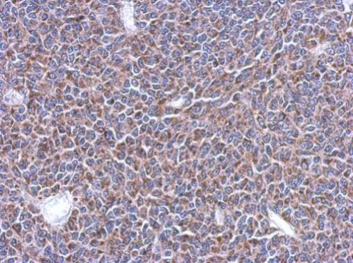 Anti-MRPL14 antibody used in IHC (Formalin-fixed paraffin-embedded sections). GTX123143
